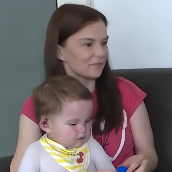 Aleksej je "BEBA LEPTIR"! Pri najmanjem dodiru njegove kože se stvaraju rane, a evo KAKO mu možemo pomoći! (VIDEO)