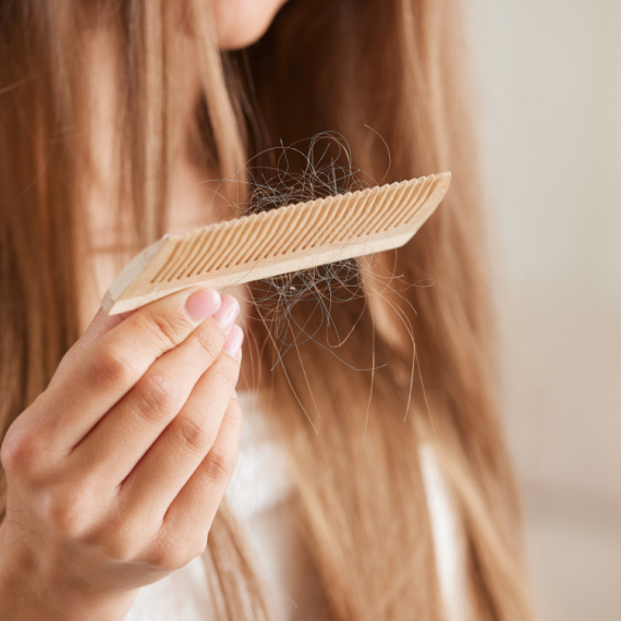 5 načina kako da SMANJITE opadanje kose