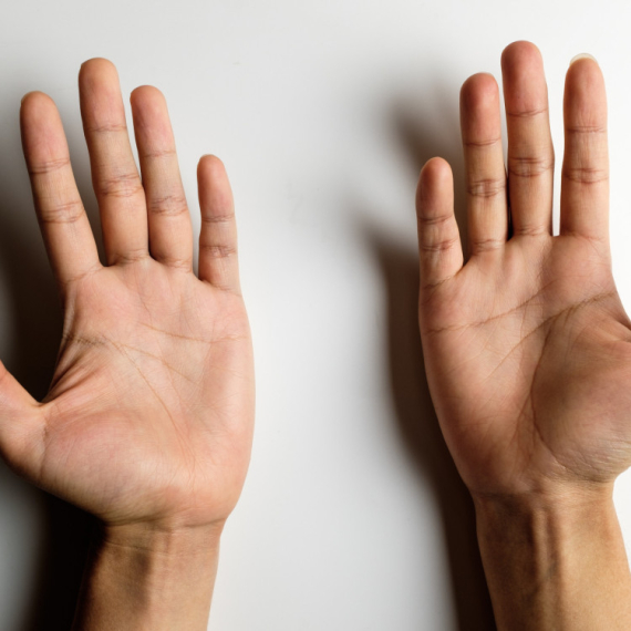 Pogledajte zglobove vaših prstiju - evo ŠTA govore o vama