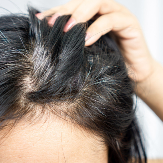 Nije uvek zbog starenja: 3 razloga zbog kojih vam kosa postaje SEDA