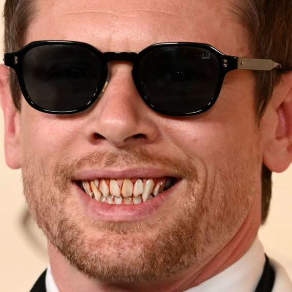 Kada se nasmejao, svima se zgadilo: Glumac pokazao JEZIVE ZUBE na crvenom tepihu Oskara (FOTO)