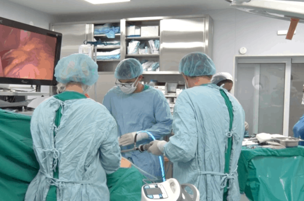 Operacija smanjenja želuca: Put od odluke do novog života (Vodič kroz pripremu i oporavak)