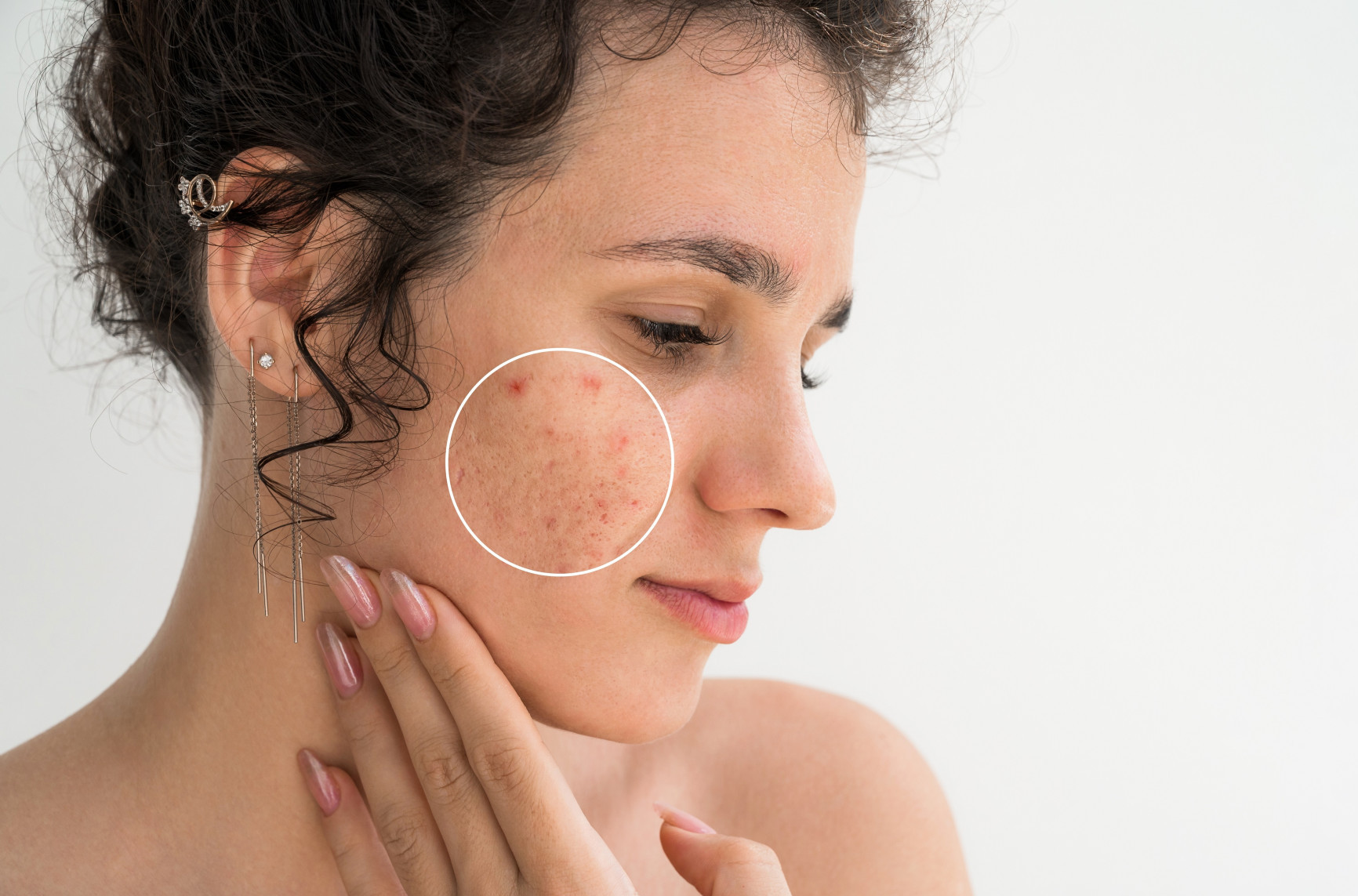 Genetika igra veliku ulogu: Tri bolesti i stanja koje se često nasleđuju