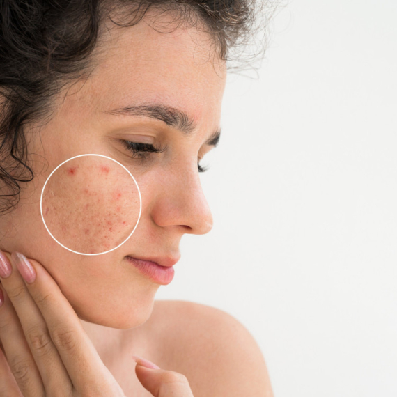 Genetika igra veliku ulogu: Tri bolesti i stanja koje se često nasleđuju