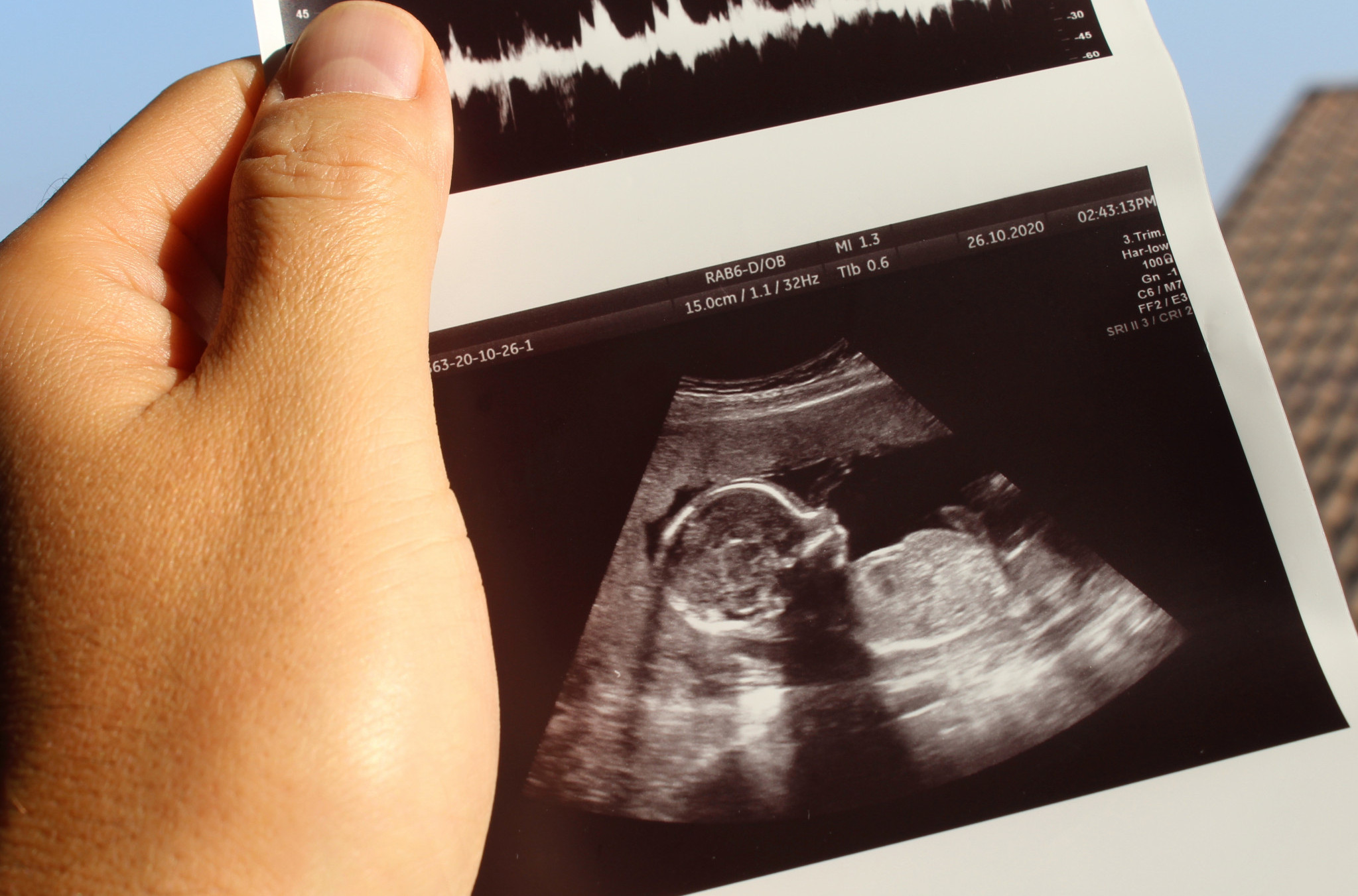 Znao je da je trudna, ali kada je video ULTRAZVUK, ostao je u ŠOKU! Reakcija ovog tate će vas ODUŠEVITI (VIDEO)