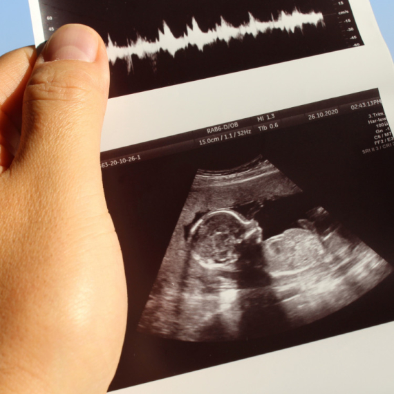 Znao je da je trudna, ali kada je video ULTRAZVUK, ostao je u ŠOKU! Reakcija ovog tate će vas ODUŠEVITI (VIDEO)