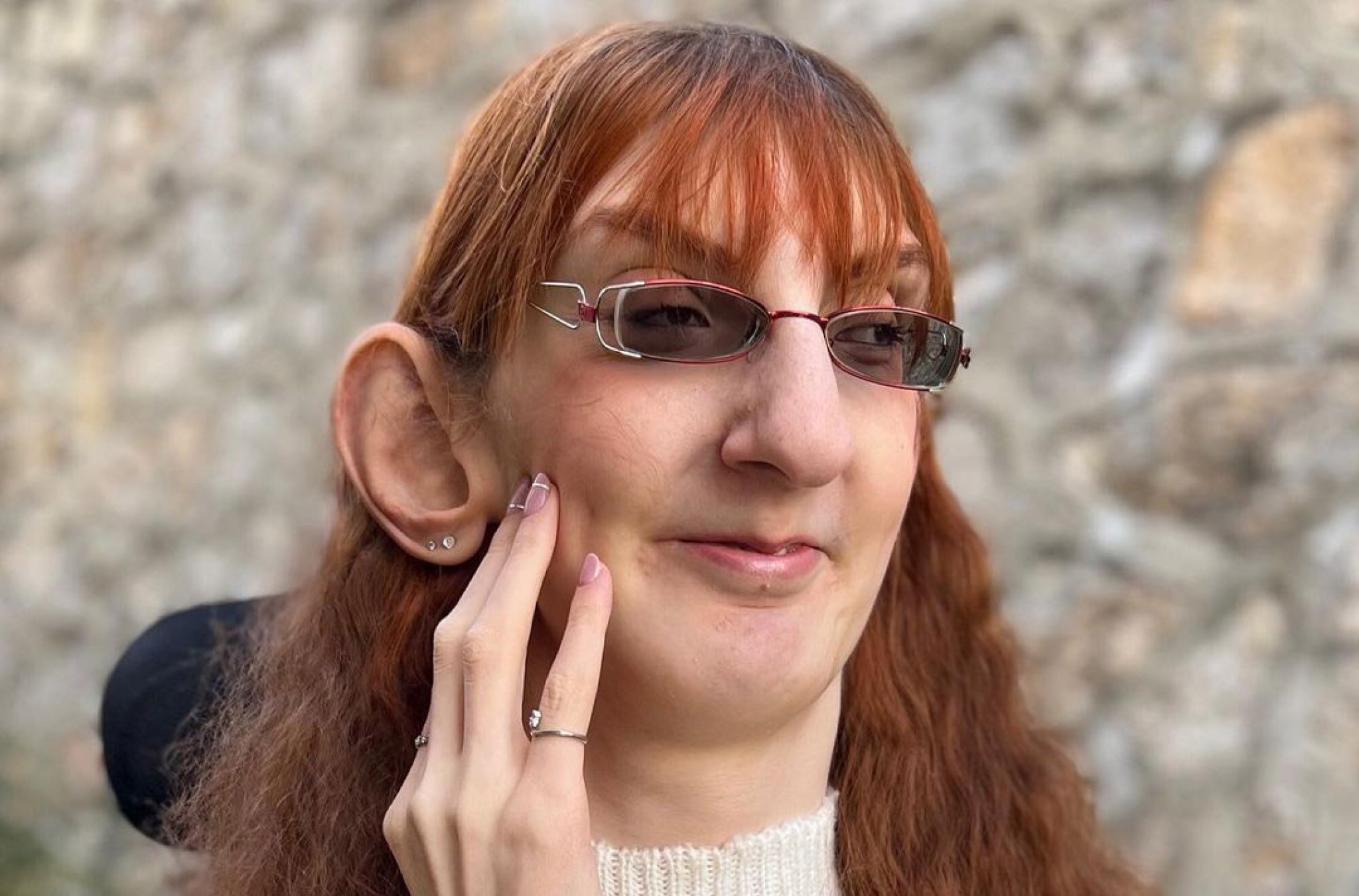 „Sada sam još POSEBNIJA I JEDINSTVENIJA!“: Najvišoj ženi na svetu posle 29 godina promenili dijagnozu, sada je JEDNA OD ŠEST POZNATIH SLUČAJEVA na svetu!