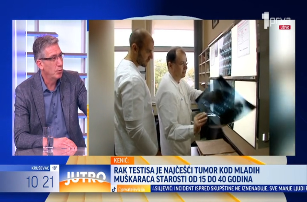 Rak testisa - o kakvom je oboljenju reč, koji su muškarci najugroženiji?