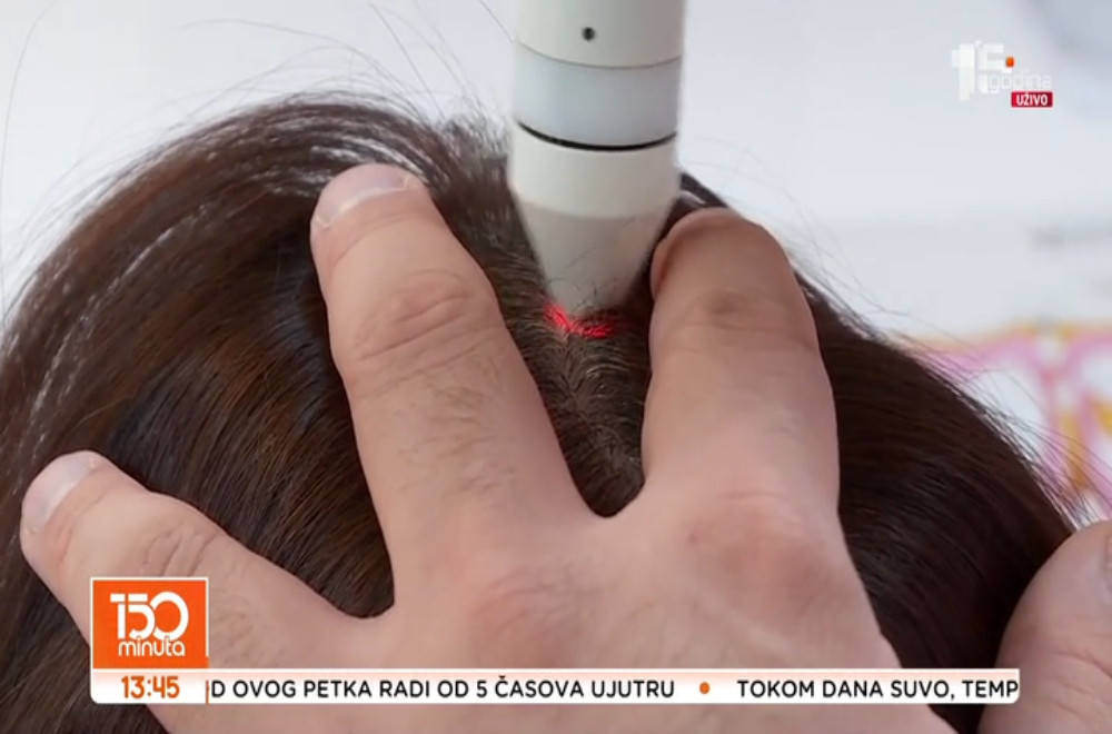 Da li i koliko vodite računa o zdravlju kose i kože?