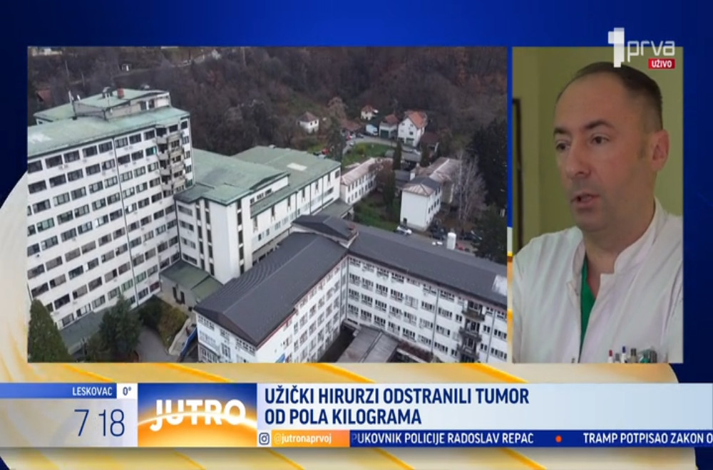 Užički hirurzi odstranili tumor od skoro pola kilograma