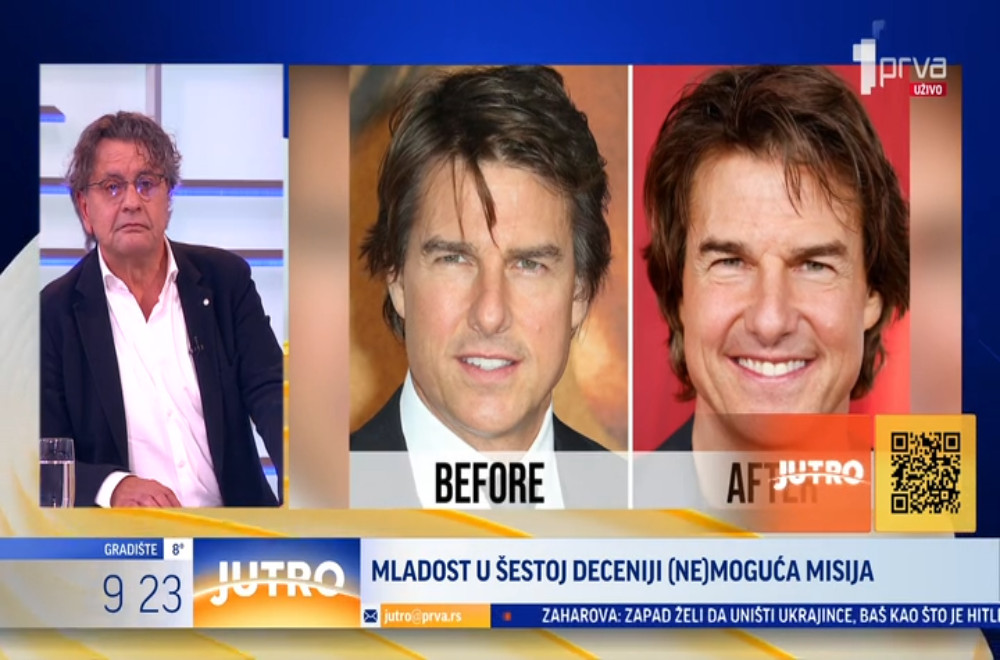 Tom Kruz sa novim licem gotovo neprepoznatljiv: Plastična hirurgija ili botoks?