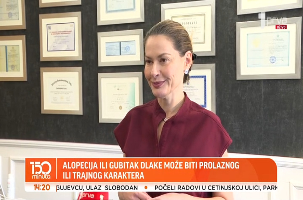 Kako se leči alopecija?