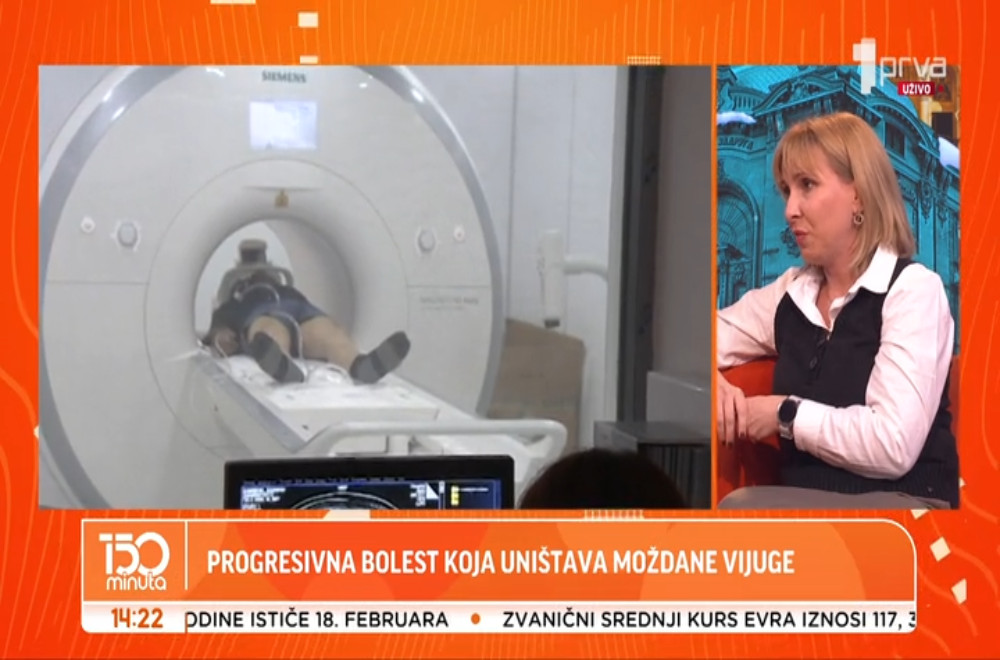 Alchajmerova bolest može da se razvija sporo, godinama