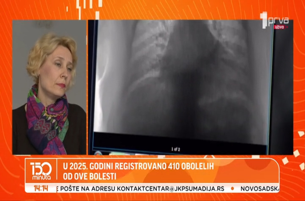 Svetski dan borbe protiv tuberkuloze