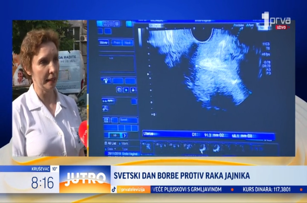 Koliko saveremena genetska testiranja utiču na lečenje raka jajnika?