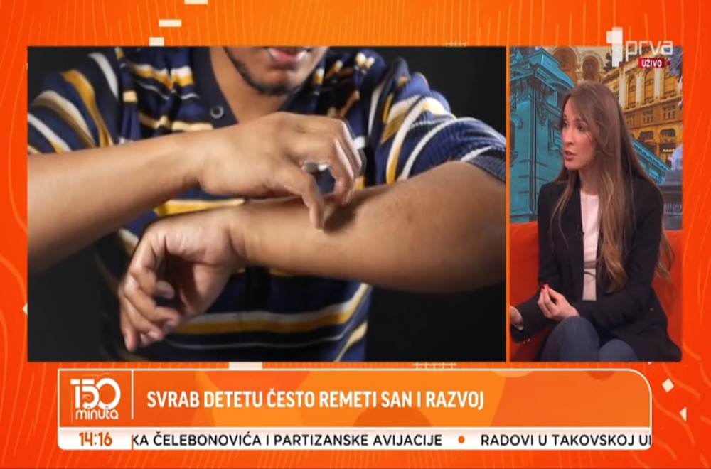 Šta je atopijski dermatitis?