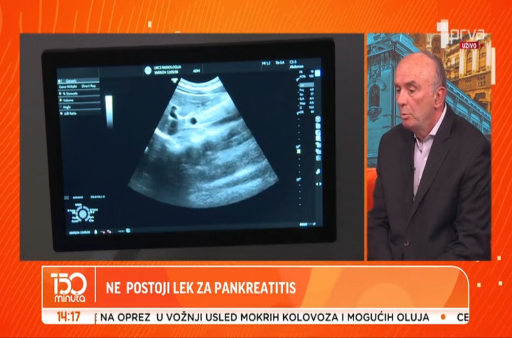 Koliko je opasan akutni pankreatitis?