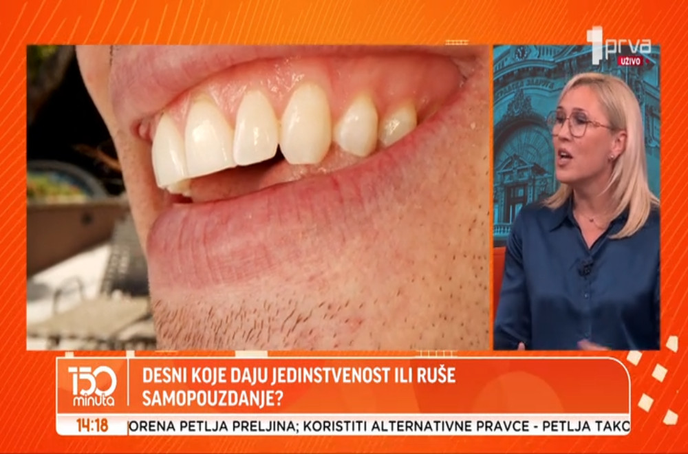 Da li prekomerno vidljive desni mogu biti više od estetskog problema?