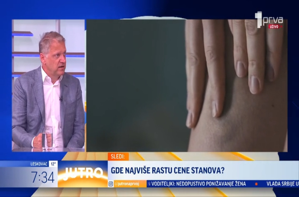 Kako nastaje tromb, ko je u najvećem riziku i šta možemo da učinimo da ga sprečimo tokom leta?