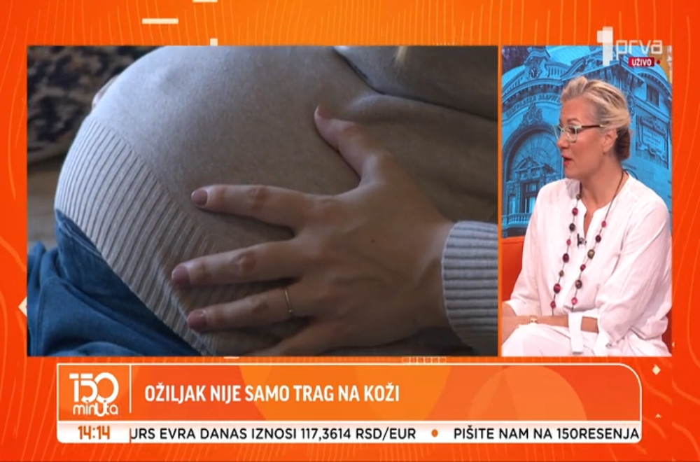 Zašto neki ožiljci bole godinama?