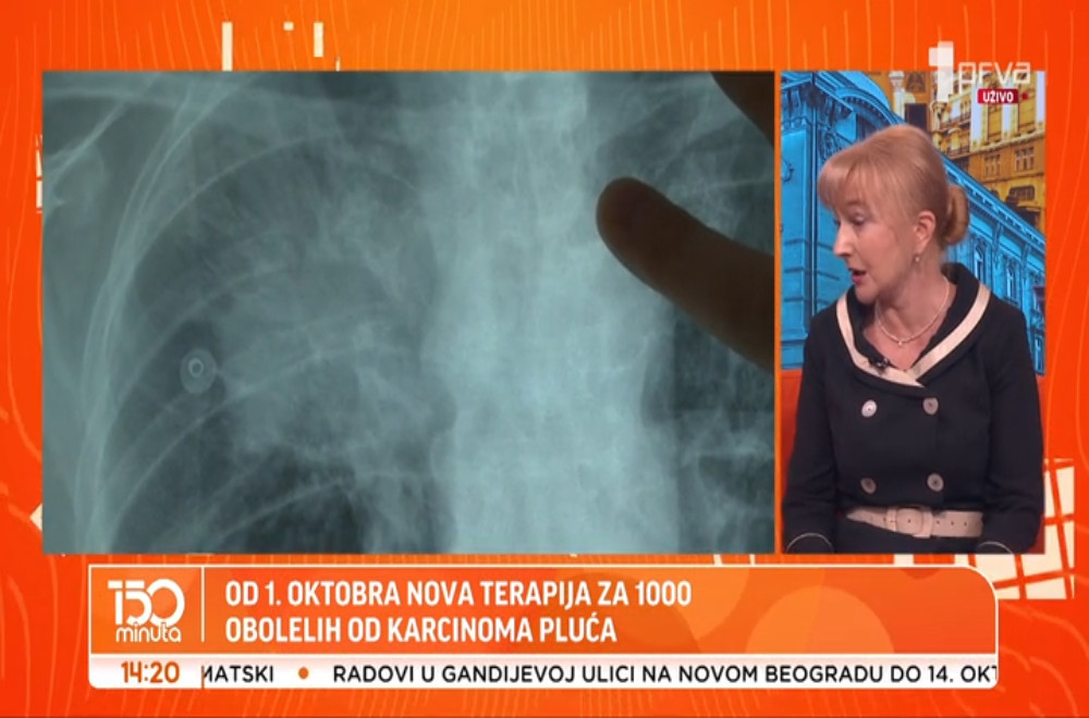 Od 1. oktobra Srbija uvodi nove terapije za karcinom pluća
