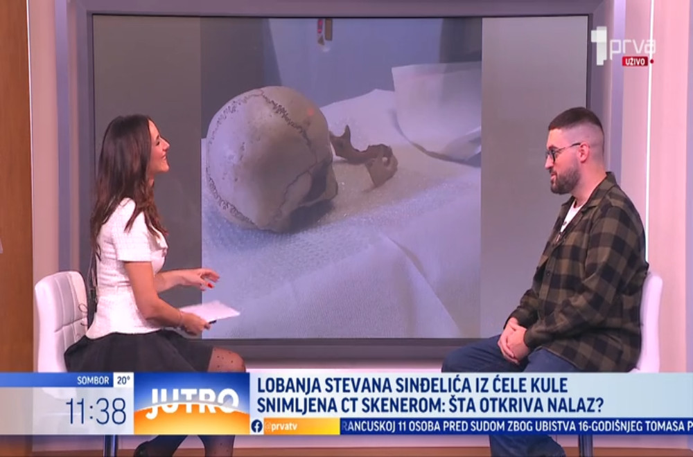 Lobanja za koju se veruje da pripada vojvodi Stevanu Sinđeliću prvi put je snimljena CT skenerom