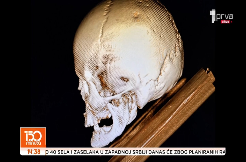 Kako savremena medicinska dijagnostička oprema može da pomogne u proučavanju istorije?