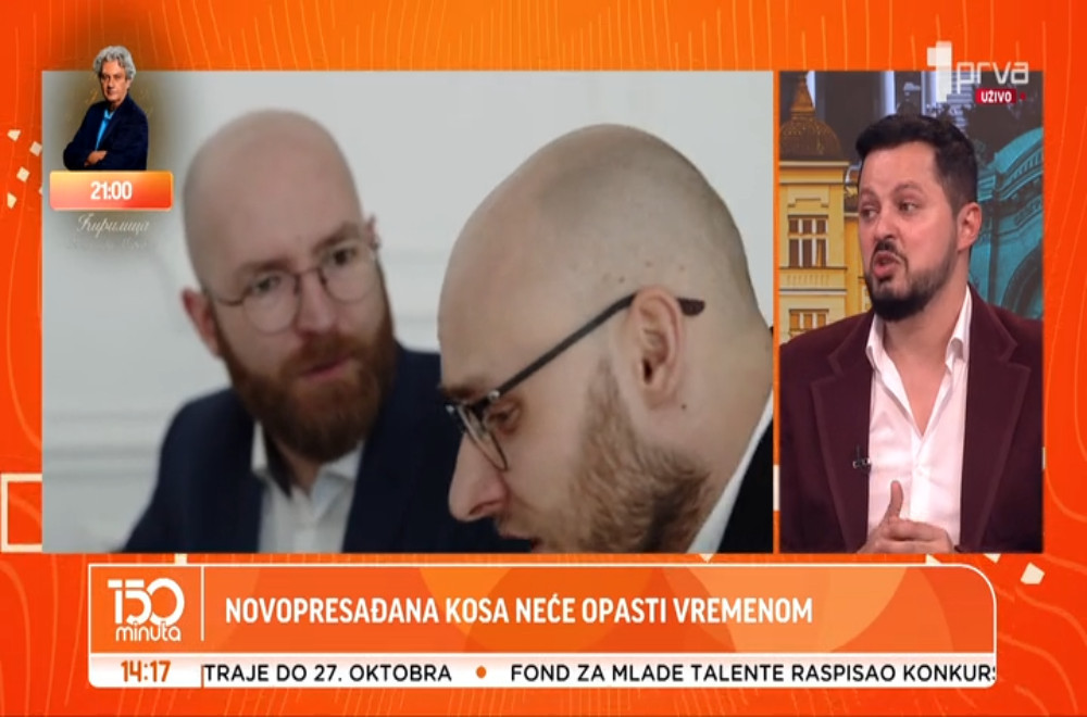 Presađivanje kose poslednjih godina sve popularnije u Srbiji