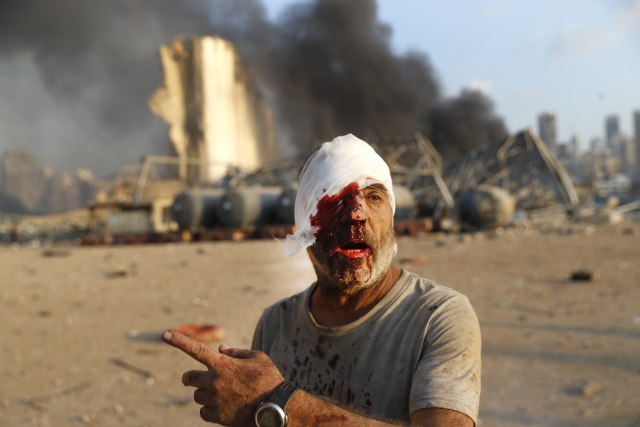 foto: Tanjug/AP Photo/Hussein Malla