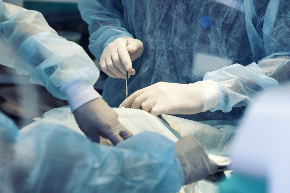 hirurka intervencija, foto: Yuriy Bartenev/Shutterstock